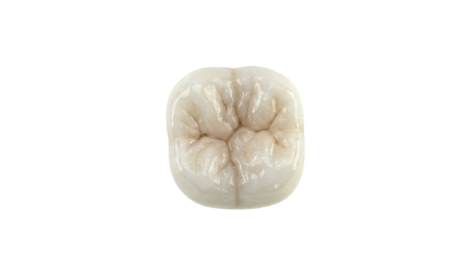 Dente cerâmica