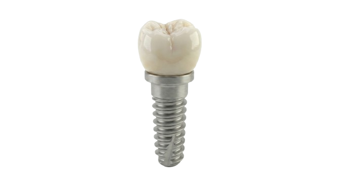 Implante dental